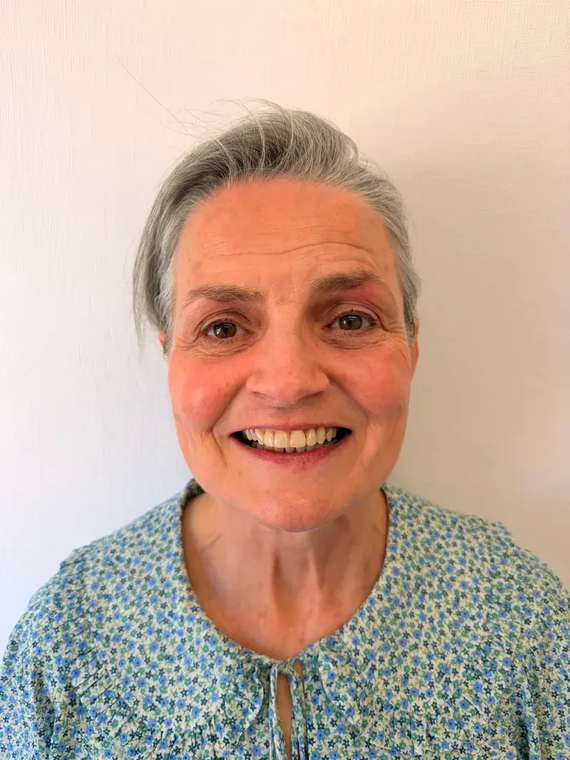 After dental implant + composite bonding treatment at Pear Tree Dental