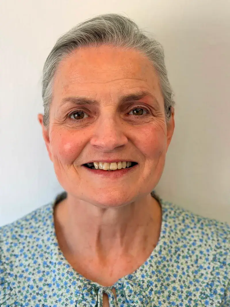 Before dental implant + composite bonding treatment at Pear Tree Dental