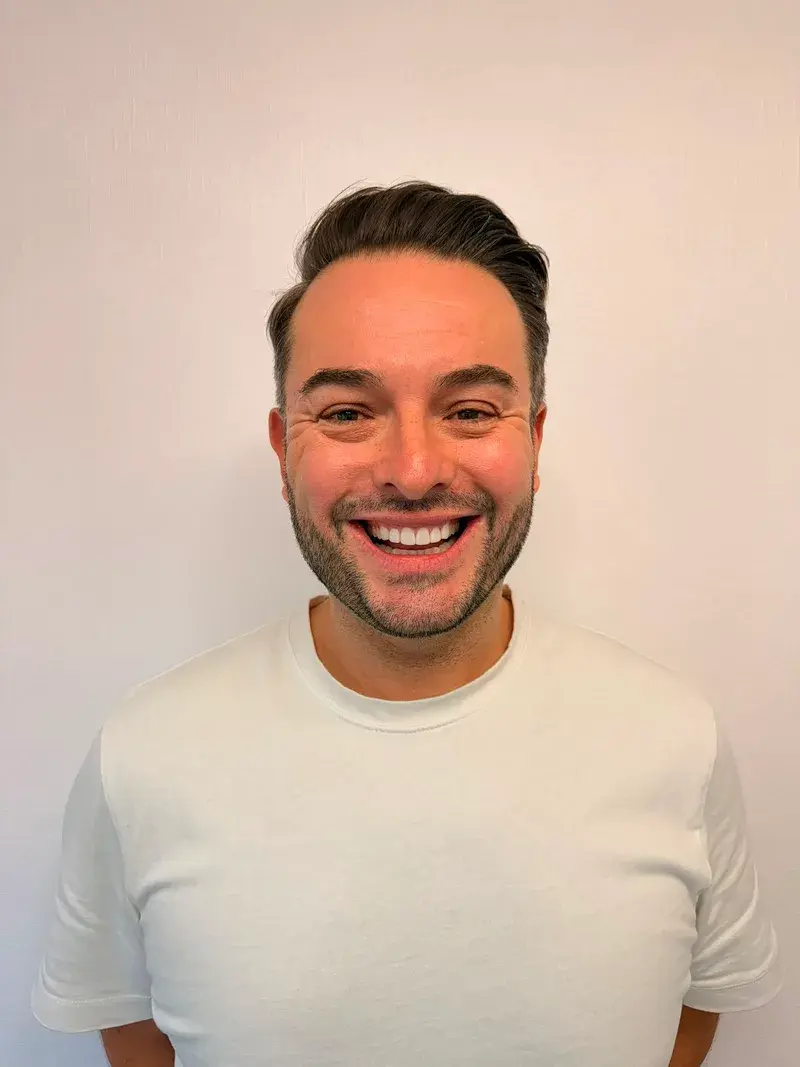 After enlighten whitening + composite bonding treatment at Pear Tree Dental
