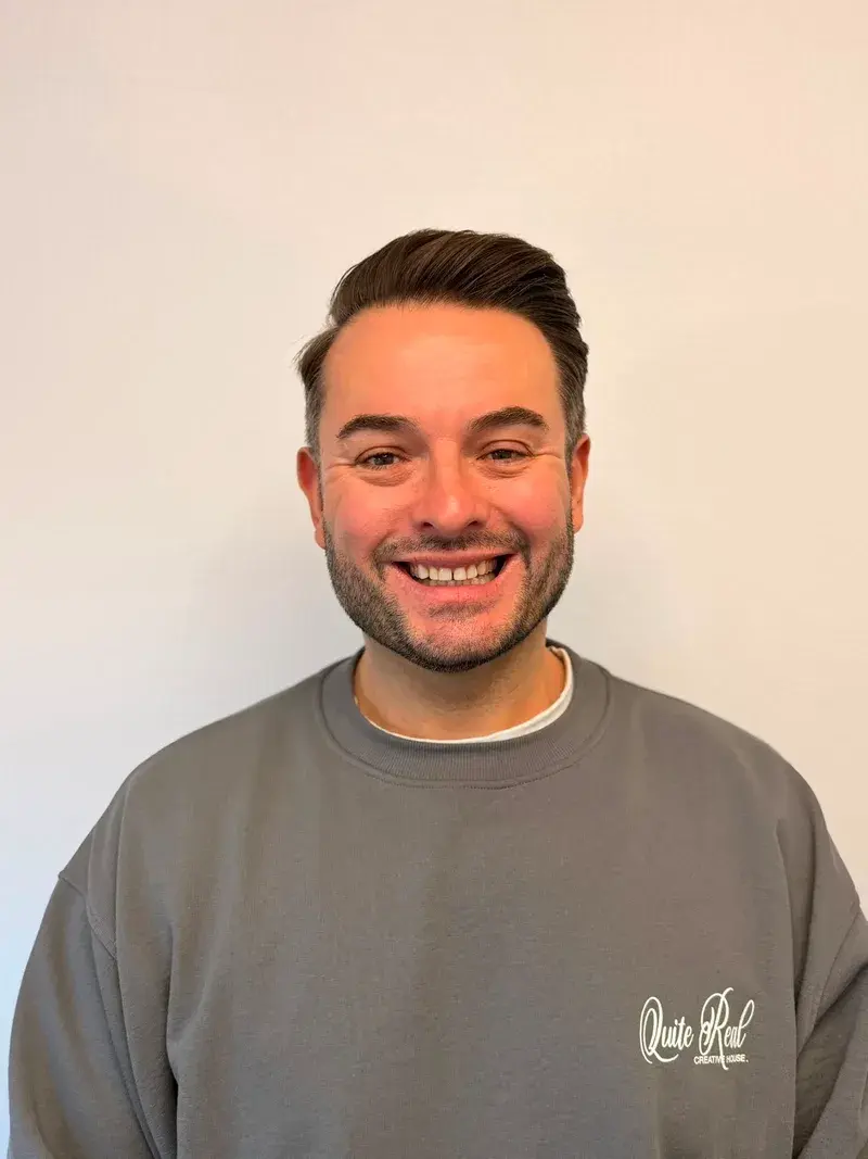 Before enlighten whitening + composite bonding treatment at Pear Tree Dental