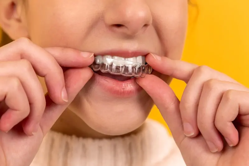 How Long Do Dental Implants Last? The Facts, Aftercare and What Affects Longevity.