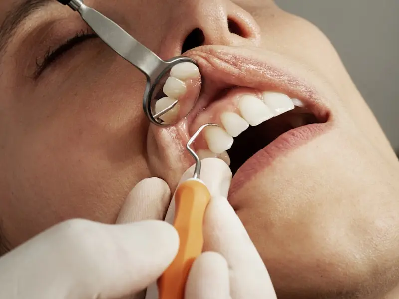 Invisalign vs Braces: Which Is Right for You in 2026?